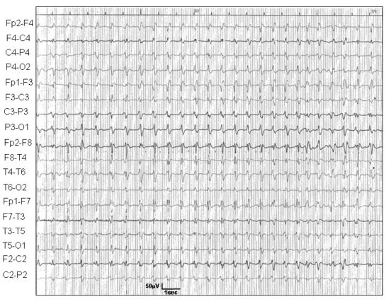 EEG (2)